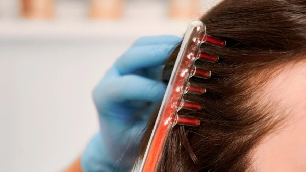 علاج الشعر بالليزر: حلّ فعال وسهل لنمو الشعر. هذا ما يجب أن تعرفيه عنه من الألف إلى الياء