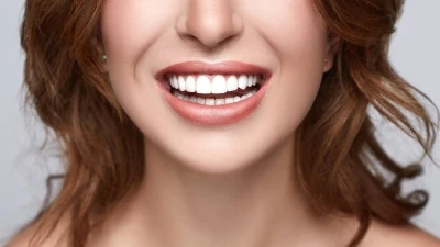 أبرز 7 مشاكل ممكن أن تصيب الأسنان