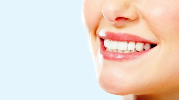دليل كامل حول تقنية لومينير الاسنان لابتسامة مثالية