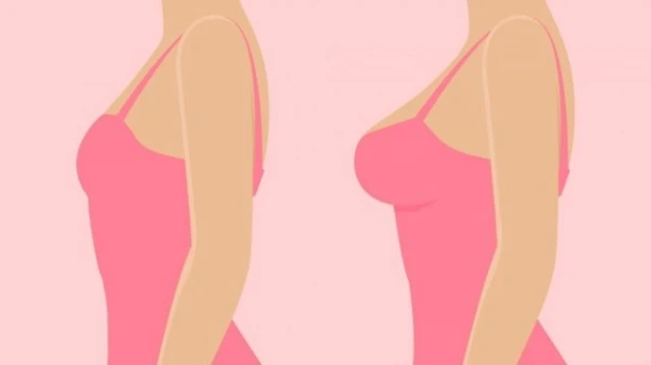 تصغير الثدي: كل ما يجب معرفته عن هذه العملية قبل الخضوع لها