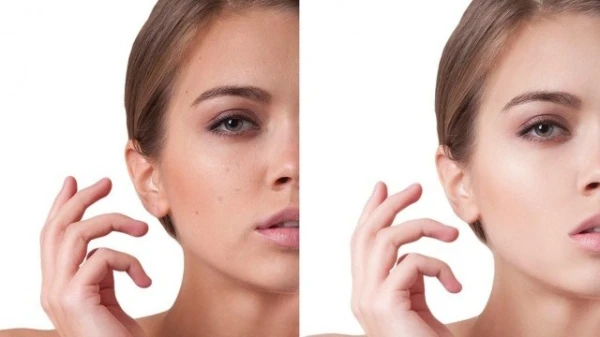 خلطة النشا لتصغير مسام الوجه وشدّ البشرة من الاستعمال الأوّل