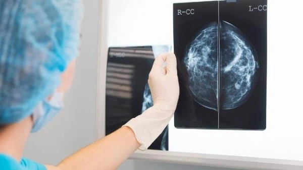 ما هي كثافة النسيج الليفي والغدي في الثدي وما علاقتها بالسرطان؟