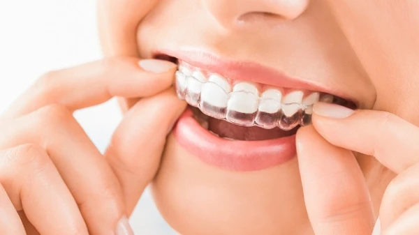 7 لصقات تبيّض أسنانكِ وتعيد الإشراقة إلى ضحكتكِ، تسوّقي منها