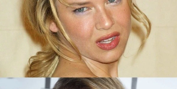 تغيّر شكل وجه Renée Zellweger على مرّ السنين
