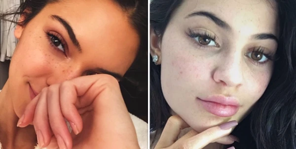 علاج بالأسيتون والثلج الجافّ وراء نقاوة بشرة Kendall وKylie Jenner