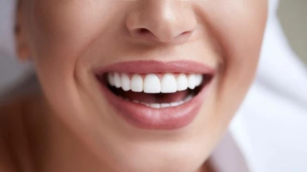 أطعمة تبيض الاسنان وتساعد على جعل ابتسامتكِ أجمل