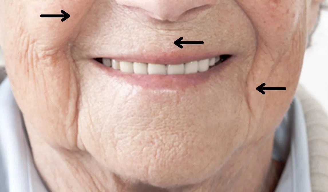 هل الاسنان تتغير مع العمر، وماذا عن الابتسامة ككلّ؟