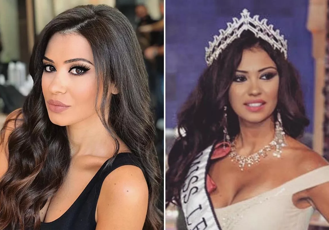 ملكة جمال لبنان لعام 2008، روزاريتا طويل قبل وبعد