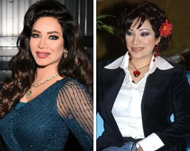 صور النجمات الخليجيات قبل وبعد عمليات التجميل لجين عمران السعودية