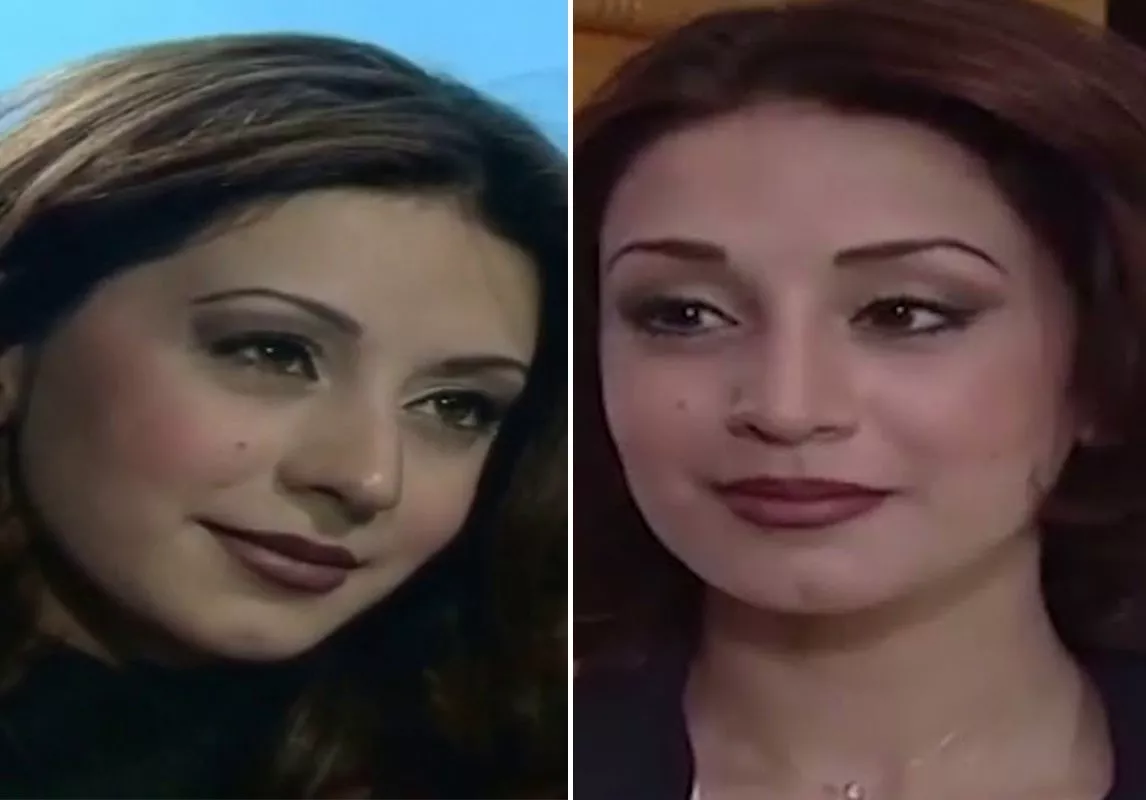 صور كاريس بشار قبل وبعد: هكذا تطوّر جمالها عبر السنوات