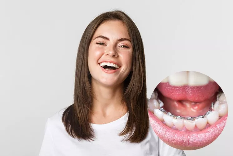 انواع تقويم الاسنان وافضلها... كل المعلومات التي تحتاجين معرفتها عنها