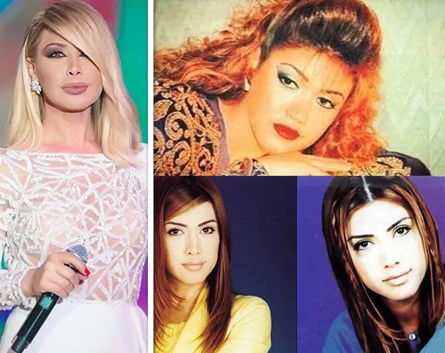 صور النجمات العربيات قبل وبعد التجميل: تغيّرات جذريّة وصادمة