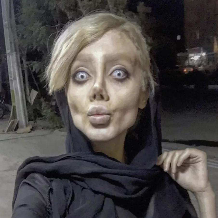هوس فتاة إيرانية بـAngelina Jolie يحوّلها إلى هيكل عظمي مرعب! حقيقة أم مزحة؟