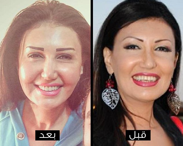 ميسرة مصر عملية تجميل