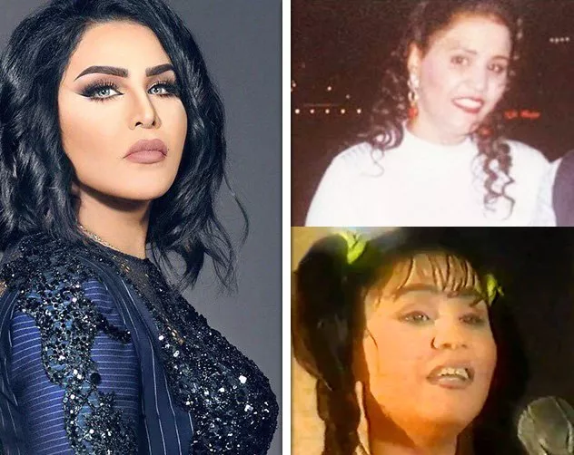 صور النجمات الخليجيات قبل وبعد عمليات التجميل أحلام الإمارات