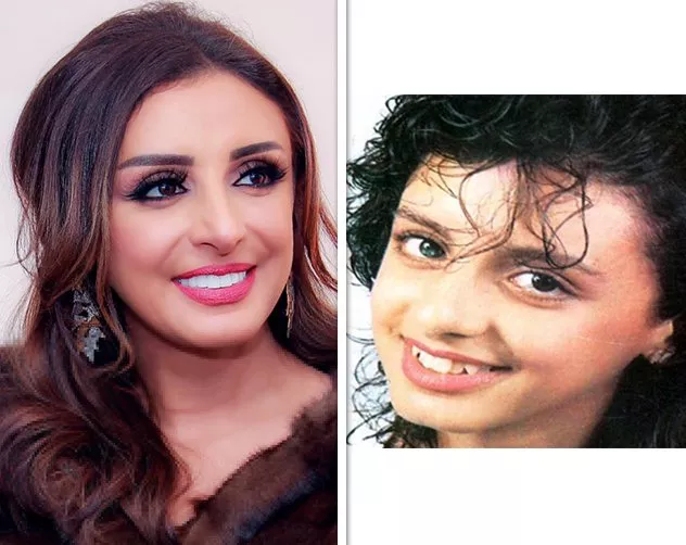 صور النجمات العربيات قبل وبعد التجميل: تغيّرات جذريّة وصادمة