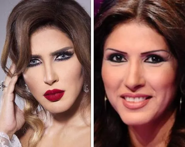 صور النجمات الخليجيات قبل وبعد عمليات التجميل زهرة عرفات البحرين