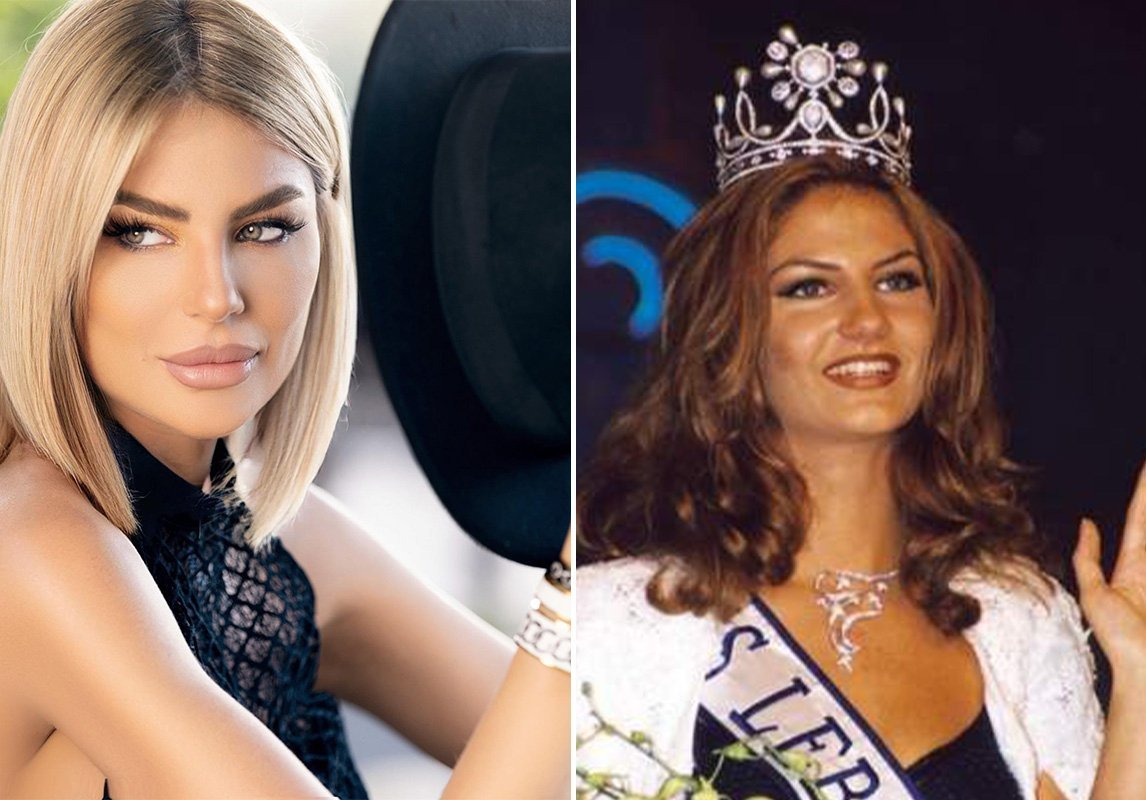 ملكة جمال لبنان لعام 2000، ساندرا رزق قبل وبعد