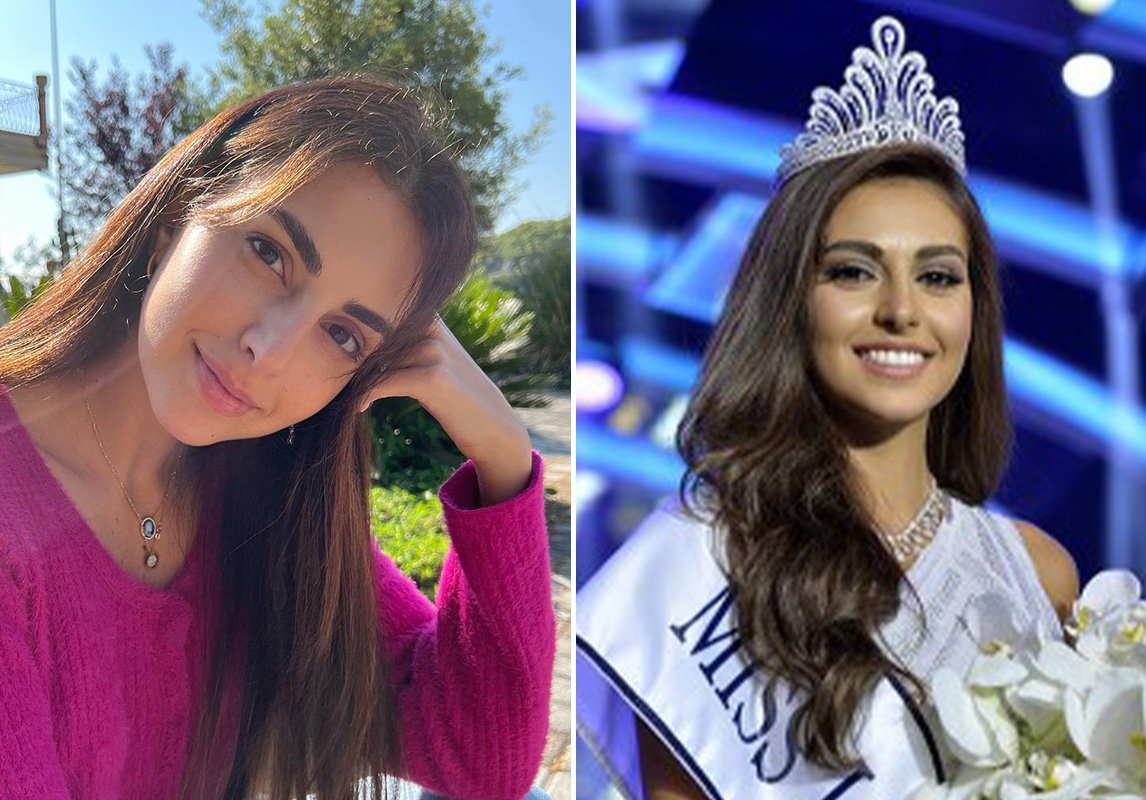 ملكة جمال لبنان لعام 2015، فاليري ابو شقرا قبل وبعد