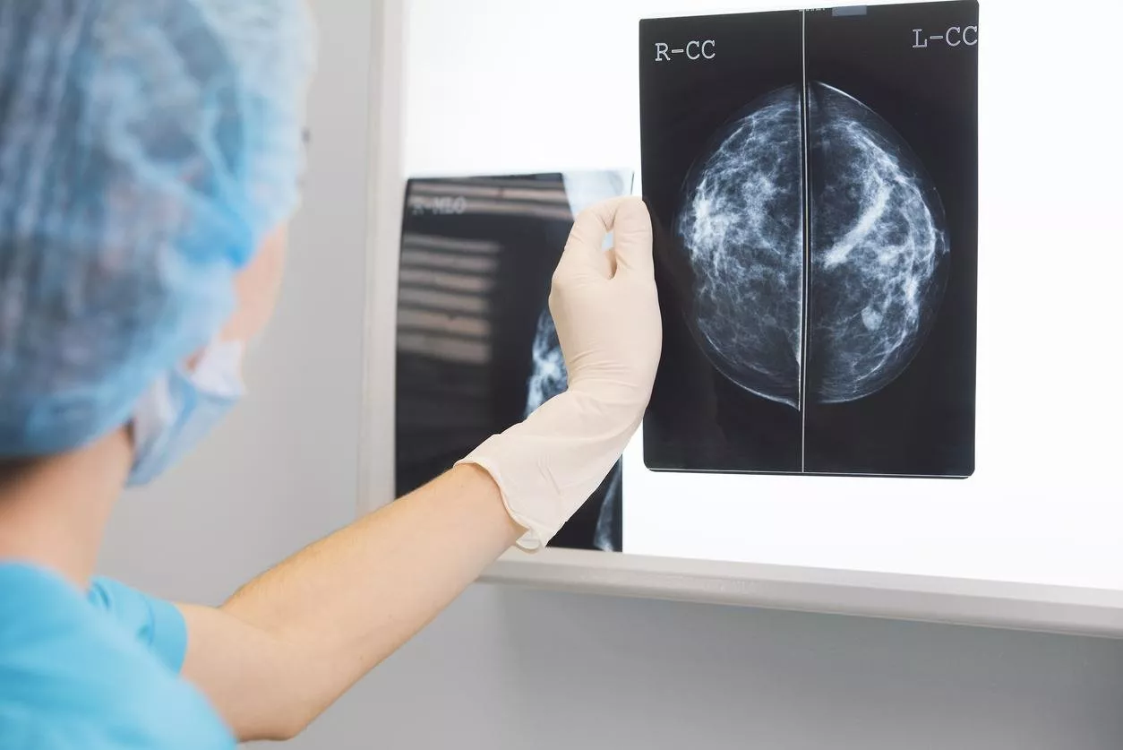 ما هي كثافة النسيج الليفي والغدي في الثدي وما علاقتها بالسرطان؟