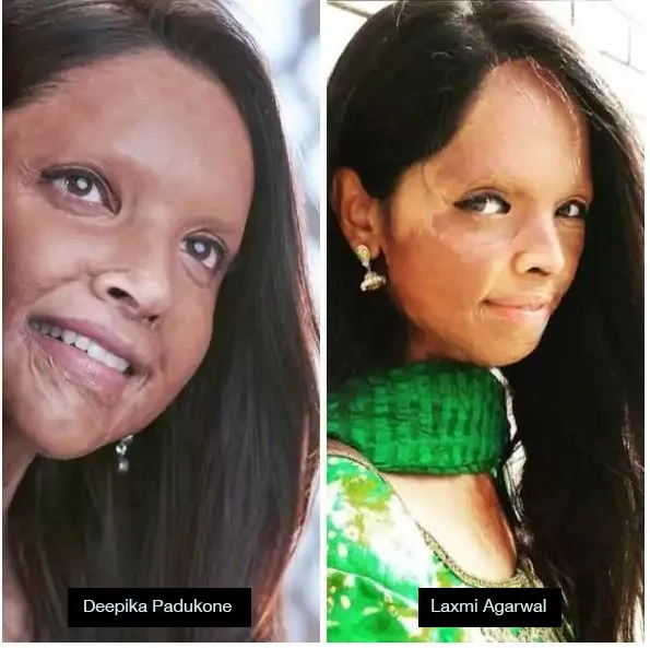 بالصورة، تغيّر صادم في وجه Deepika Padukone... ما السبب؟!