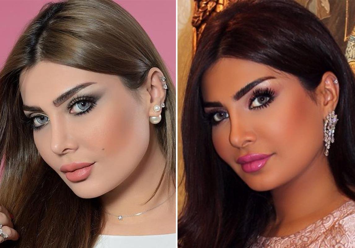 أمل العوضي قبل وبعد صور أمل العوضي قبل عمليات التجميل 