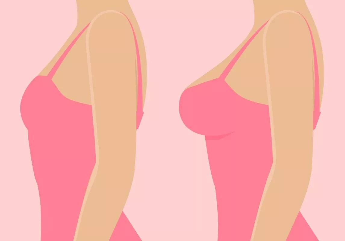 تصغير الثدي: كل ما يجب معرفته عن هذه العملية قبل الخضوع لها