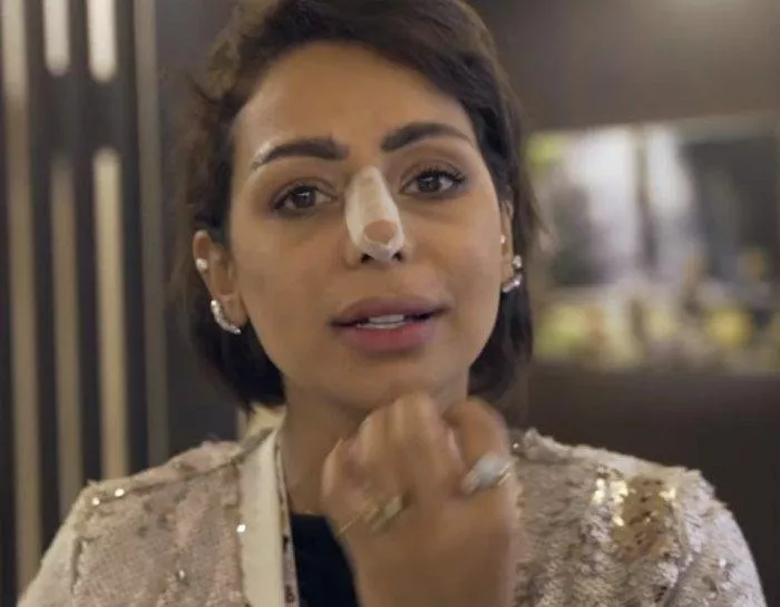 هند البلوشي تخضع لعملية تجميل في أنفها بعد تعرّضها لحادث سير