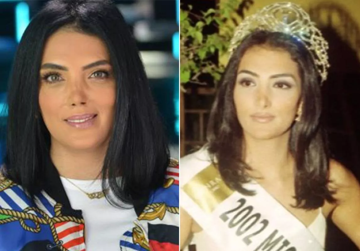 صور ملكات الجمال قبل وبعد: كيف تغيّرت ملامحهنّ عبر السنوات؟