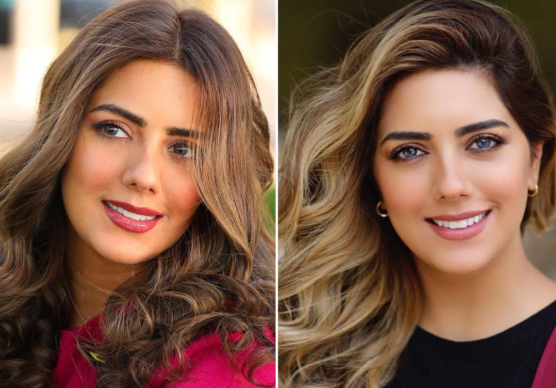 صور هيا عبدالسلام قبل وبعد