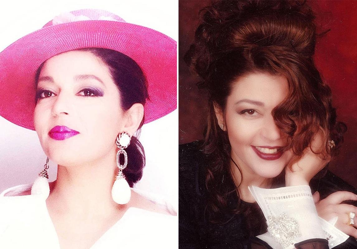 صور سميرة سعيد قبل وبعد عمليات التجميل