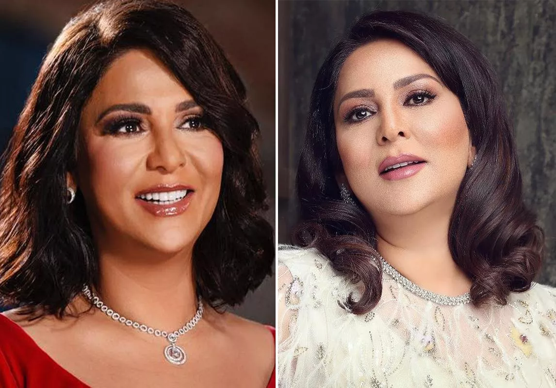 صور نوال الكويتية قبل وبعد: تطوّر جمالها عبر السنوات