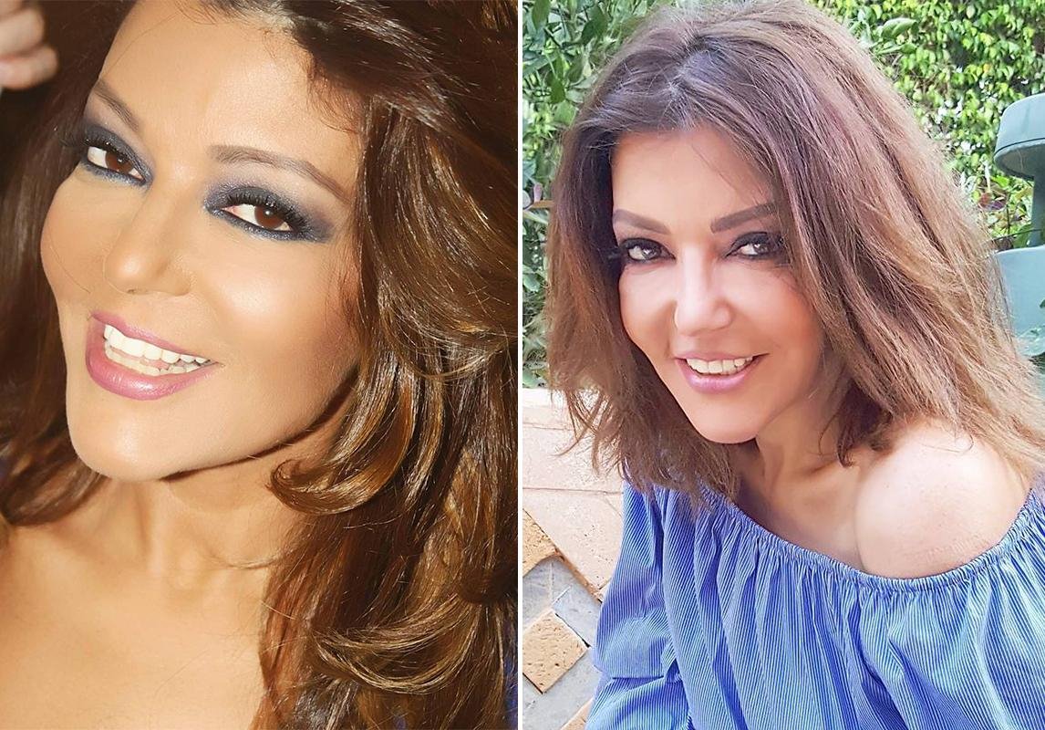 صور سميرة سعيد قبل وبعد عمليات التجميل
