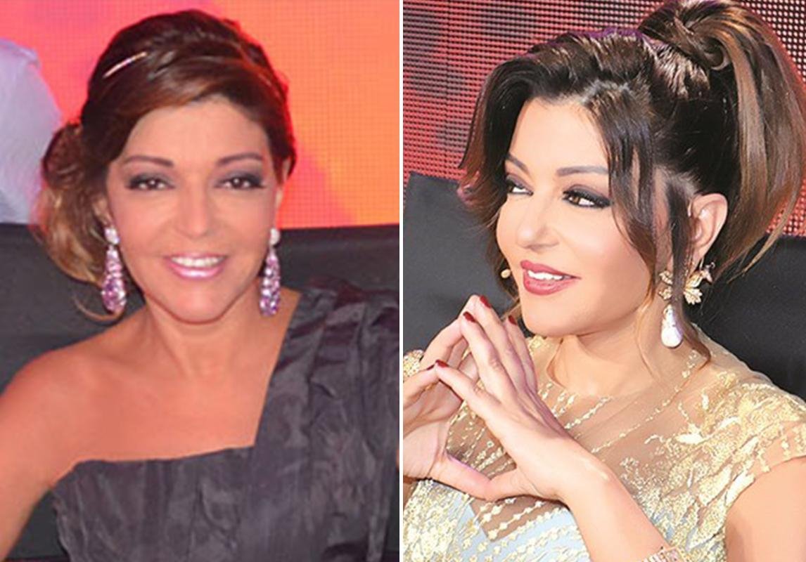 صور سميرة سعيد قبل وبعد عمليات التجميل